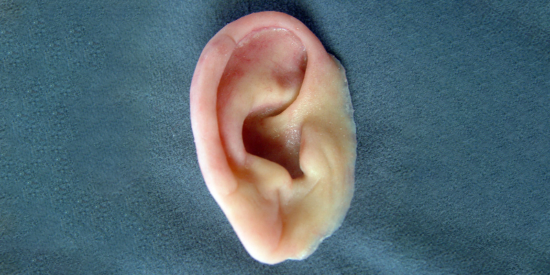 تصویر نمونه پروتز گوش سیلیکونی